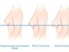 Подтяжка грудных желез без имплантов: безупречно и естественно Подтяжка груди без увеличения