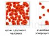 Cos’è l’anemia e come trattarla?
