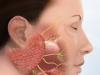 Inflammation du nerf trijumeau Maladie du nerf trijumeau du traitement du visage