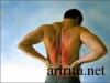 Como distinguir artrose de artrite