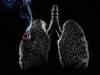 Τα πρώτα σημάδια του καρκίνου του πνεύμονα Πώς να προσδιορίσετε το στάδιο του καρκίνου του πνεύμονα