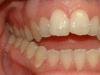 أخصائي تقويم الأسنان - كل ما يتعلق بالتخصص الطبي