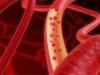 Wie unterscheiden sich Arterien von Venen?