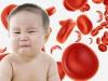 Si un bebé tiene anemia Escuela del Doctor Komarovsky medicina para la anemia
