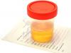Is it dangerous for a child to have blood in his urine?