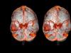 CT இலிருந்து MRI எவ்வாறு வேறுபடுகிறது: எந்த ஆய்வு மிகவும் துல்லியமானது, அதிக தகவல் மற்றும் பாதுகாப்பானது - எது சிறந்தது?
